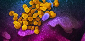 Dünyada yeni növ koronavirusa yoluxanların sayı 7 milyonu ötüb.